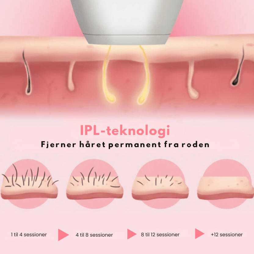 IPL-laserhårfjerner