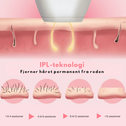 IPL-laserhårfjerner